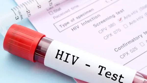 test-hiv-2